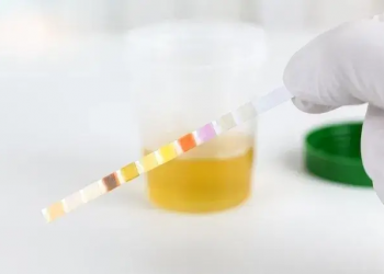Memahami Keton Urine: Penanda Penting Metabolisme Tubuh